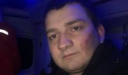 По сценарию Бабченко: избиение депутата от партии Зеленского инсценировала СБУ