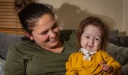 "Болезнь Бенджамина Баттона" выявлена у британки