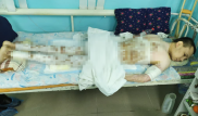 Актюбинец получил ожоги, спасая человека из огня