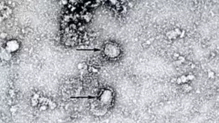 Найдено лекарство китайской медицины, сдерживающее коронавирус