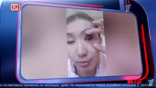 Жительница Кентау попала в больницу после посещения салона красоты