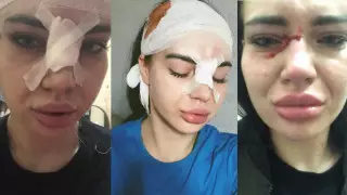 "Меня стали затаптывать". ЧП в ночном клубе Караганды