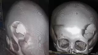 Детский хирург из Актау спас жизни двум девочкам за одну ночь