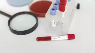 Когда в Алматы завезут экспресс-тесты на коронавирус