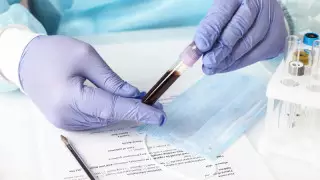 Что известно о зараженных коронавирусом в ВКО