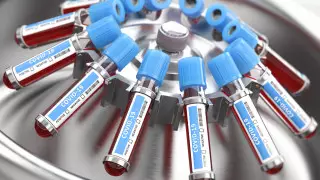 О новых случаях коронавируса рассказали в Караганде