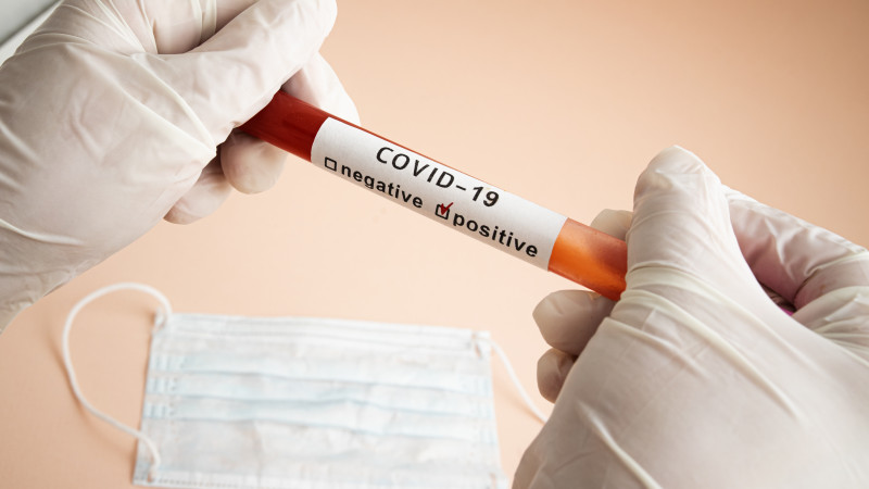Число заразившихся COVID-19 выросло до 444 в Казахстане