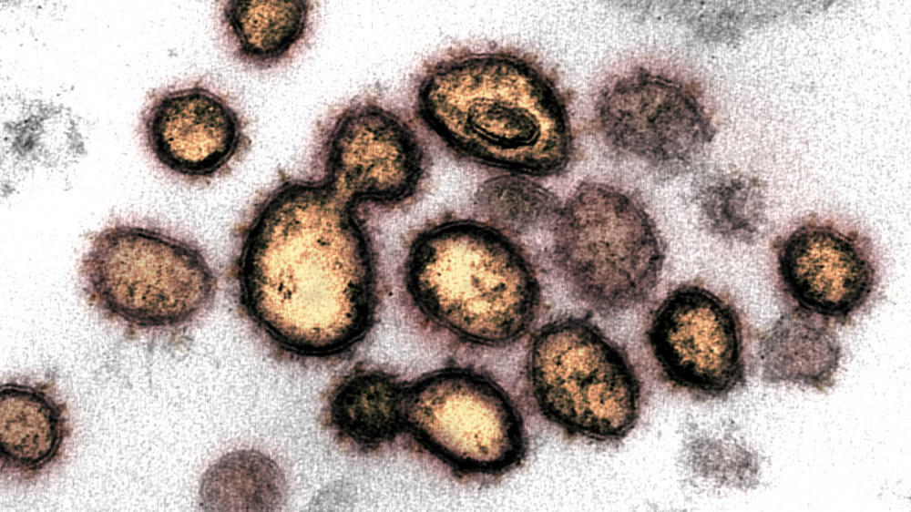 В теле человека обнаружены новые очаги размножения коронавируса