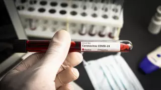 5 новых случаев COVID-19 зафиксировали в Казахстане