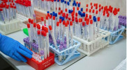 Об опасных последствиях заражения COVID-19 предупредили ученые