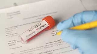 В Нур-Султане за 2 дня зарегистрировали 34 новых случая коронавируса