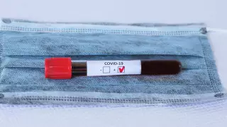 Гражданин Казахстана умер от коронавируса в России