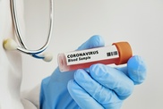 Число вылечившихся от COVID-19 достигло 428 в Казахстане