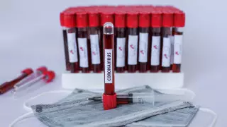 Казахстан достиг пика эпидемии COVID-19 - Биртанов