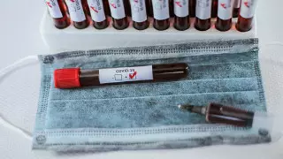 Число случаев коронавируса в мире превысило 2,5 миллиона