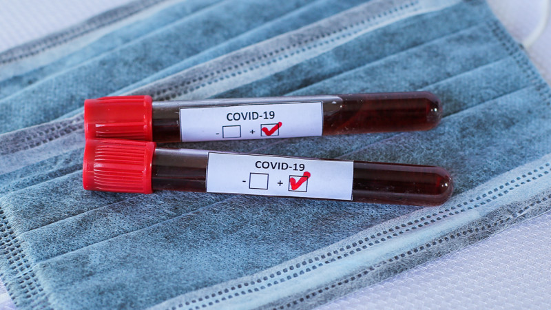 Еще 56 случаев коронавируса зафиксированы в Казахстане