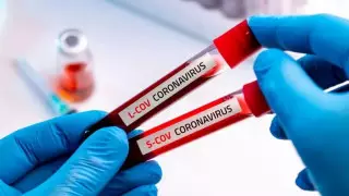 Бас санитар дәрігер коронавирус қандай ауруы бар адамдарға аса қауіпті екенін айтты