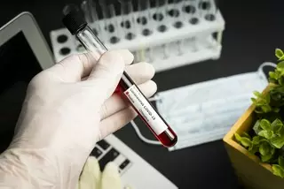 Кровью "излечившихся от коронавируса" торгуют в Даркнете