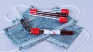 Семь иностранцев болеют COVID-19 в Казахстане