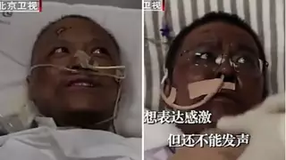 Почерневший от COVID-19 врач начал светлеть