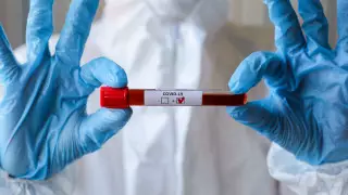 ТМД-ның қай елінде коронавирус жұқтыру дерегі азайды?