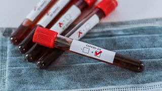 Коронавирус выявили у сотрудницы акимата в Мангистау