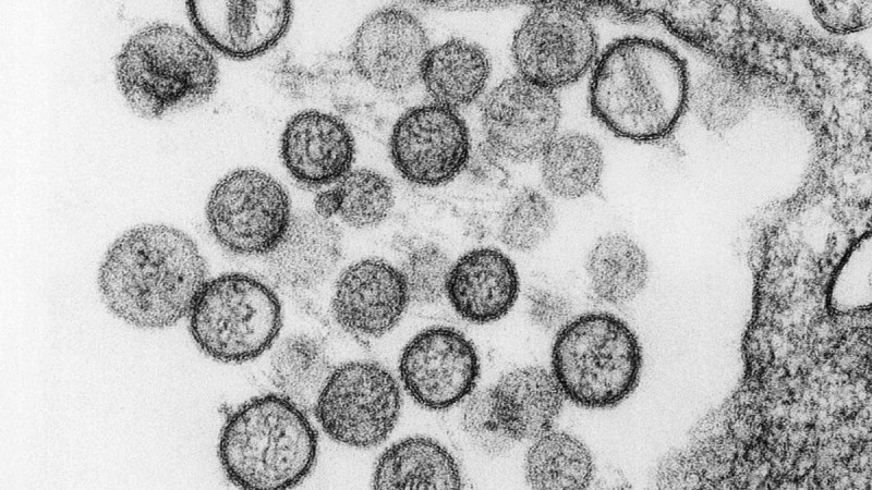 Хантавирус под микроскопом. © Reuters