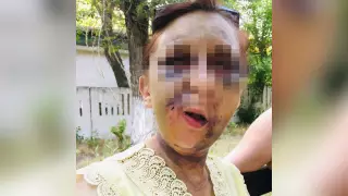 Сломаны челюсть и ребра: женщину жестоко избили в Шымкенте