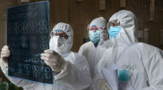 COVID-19 представляет глобальную угрозу всей нервной системе - ученые