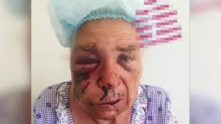 Дело о странном избиении пенсионерки раскрыто в Алматинской области