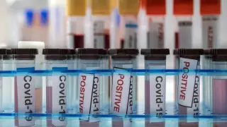 1,2 миллиона тестов на коронавирус закупит Казахстан