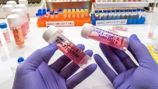 Когда в Алматы появятся платные тесты на коронавирус