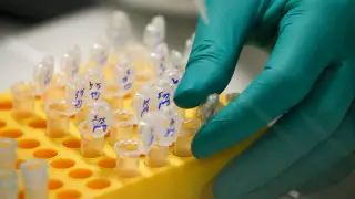 Назван резко повышающий риск смерти от рака фактор