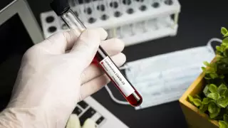 "Тест - ем емес". Надыров "жай ғана сақтану үшін" тест тапсыратындарға үндеу жасады