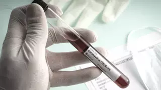 Не ходить в лаборатории с кашлем просит Минздрав