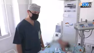 Двухголовый младенец родился в Узбекистане