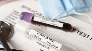 1604 человека заразились коронавирусом в Казахстане за сутки