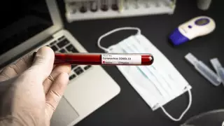 Қазақстанда күніне қанша ПТР талдау жасалатыны айтылды