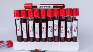 Банк плазмы выздоровевших от коронавируса хотят создать в Алматы