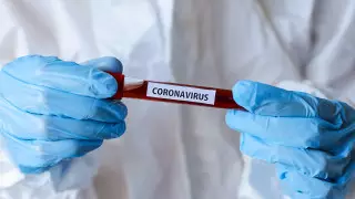 1376 новых случаев коронавируса зарегистрированы в Казахстане