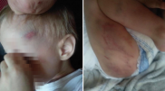 3-летнего ребенка избили в Алматы