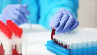 Ученые нашли необычный способ продлить жизнь