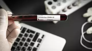 Излечился, а ПЦР положительный: врач объяснила причину