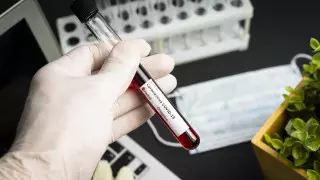 Иммунитет и повторное заражение коронавирусом. Ученые отвечают на вопросы