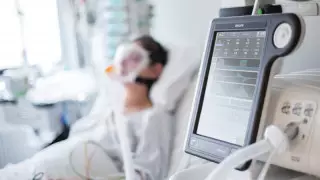 Пациента со 100-процентным поражением легких спасли в Алматы