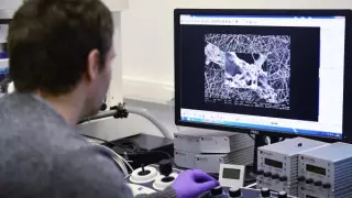 О повторных заражениях коронавирусом спросили Минздрав