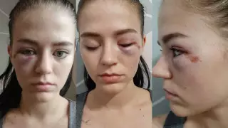 "Бил головой о капот": задержан подозреваемый в нападении на алматинку