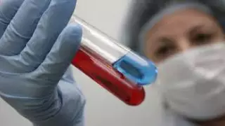 Очаг птичьего гриппа выявили в приграничной с Казахстаном области России