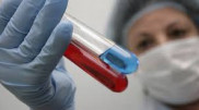 Очаг птичьего гриппа выявили в приграничной с Казахстаном области России