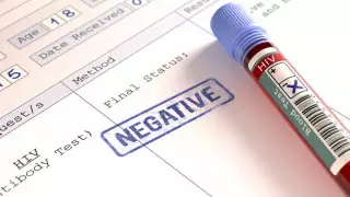 Впервые пациент поборол ВИЧ без терапии